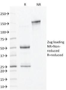 SDS-PAGE analysis of Anti-ALDH1A1 Antibody [ALDH1A1/1381] under non-reduced and reduced conditions; showing intact IgG and intact heavy and light chains, respectively SDS-PAGE analysis confirms the integrity and purity of the antibody