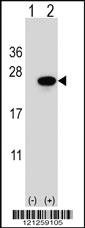 Anti-SAR1A Rabbit Polyclonal Antibody