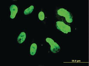 Anti-TBX3 Mouse Monoclonal Antibody [clone: 3A7]