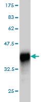 Anti-RNF14 Mouse Monoclonal Antibody [clone: 4G9]