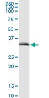 Anti-TIRAP Polyclonal Antibody Pair