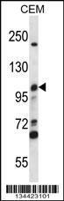 Anti-MCM4 Rabbit Polyclonal Antibody