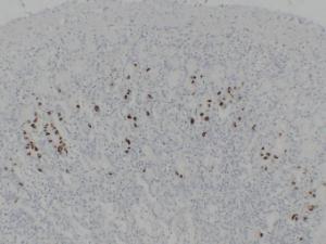 Immunohistochemical analysis of paraffin-embedded human Stomach using Anti-Gastrin Antibody