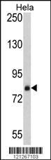 Anti-SRP72 Rabbit Polyclonal Antibody