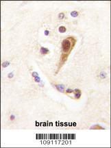 Anti-LHX6 Rabbit Polyclonal Antibody (HRP (Horseradish Peroxidase))