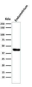 Western blot analysis of endometrium muscle tissue lysate using Anti-Muscle Actin Antibody [HHF35]