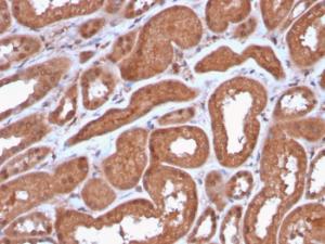 Immunohistochemical analysis of formalin-fixed, paraffin-embedded human kidney using Anti-MTAP Antibody [MTAP/3137R]