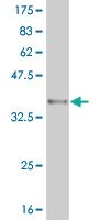 Anti-ARID1B Mouse Monoclonal Antibody [clone: 2F2]