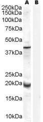 Anti-GPX7 Antibody (A84231) (0.3µg/ml) staining of Human Prostate lysate (35µg protein in RIPA buffer) with (B) and without (A) blocking with the immunising peptide. Primary incubation was 1 hour. Detected by chemiluminescence.