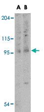 Anti-TNFAIP3 Rabbit Polyclonal Antibody