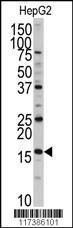 Anti-DCTPP1 Rabbit polyclonal antibody