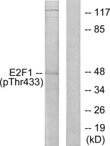 Anti-E2F1