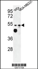 Anti-MALD2 Rabbit Polyclonal Antibody