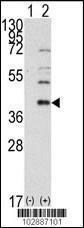 Anti-SAE1 Rabbit Polyclonal Antibody (Biotin)