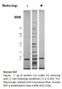 Human Recombinant EGF (from <i>E. coli</i>)