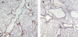 Anti-UNC13D Antibody (A84232) (0.5µg/ml) staining of paraffin embedded Mouse Lung (wt in A and KO in B)