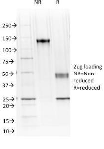 SDS-PAGE analysis of Anti-Cadherin 16 Antibody [CDH16/1071] under non-reduced and reduced conditions; showing intact IgG and intact heavy and light chains, respectively. SDS-PAGE analysis confirms the integrity and purity of the antibody