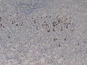 Immunohistochemical analysis of paraffin-embedded human Stomach using Anti-Gastrin Antibody