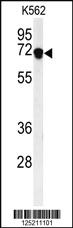 Anti-DEN1A Rabbit Polyclonal Antibody