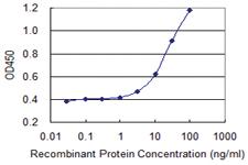 Anti-PRKDC Mouse Monoclonal Antibody [clone: 1B9]