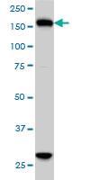 Anti-KIF15 Mouse Monoclonal Antibody [clone: 4D4]