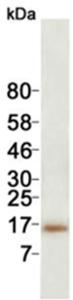 Western blotting res µlt