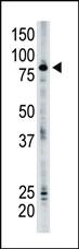 Anti-SMURF2 Rabbit Polyclonal Antibody