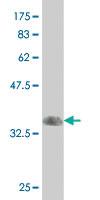 Anti-RXRG Mouse Monoclonal Antibody [clone: 6H1]