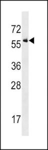 Anti-ACVR1 Rabbit Polyclonal Antibody (Biotin)