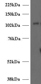 Anti-UNC13D Antibody (A84232) (2µg/ml) staining of Human T-lymphocyte lysate (35µg protein in RIPA buffer). Primary incubation was 1 hour. Detected by chemiluminescence.