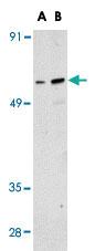 Anti-RUNX1 Rabbit Polyclonal Antibody