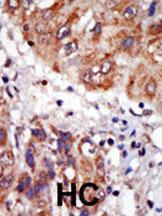 Anti-LIMK1 Rabbit Polyclonal Antibody (AP (Alkaline Phosphatase))