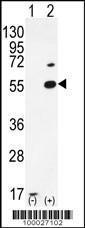 Anti-PRMT2 Rabbit Polyclonal Antibody (HRP (Horseradish Peroxidase))