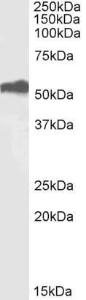 Anti-ETV4 antibody