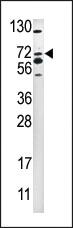 Anti-SMURF2 Rabbit Polyclonal Antibody