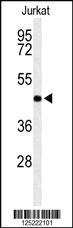 Anti-RPR1B Rabbit Polyclonal Antibody