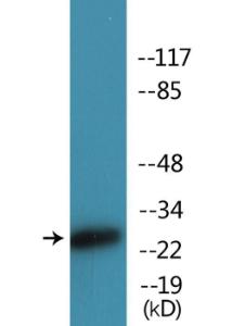 Western blot analysis of lysates from HepG2 cells treated with nocodazole 1 µg/ml 16h using Anti-CD28 (phospho Tyr218) Antibody