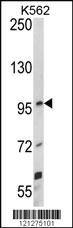 Anti-SYT6 Rabbit Polyclonal Antibody