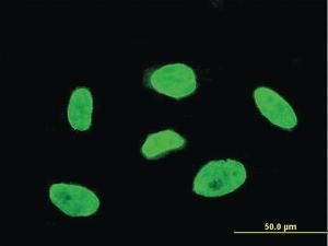 Anti-TBX3 Mouse Monoclonal Antibody [clone: 7B3]