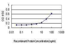 Anti-PGAP1 Mouse Monoclonal Antibody [clone: 5G6]