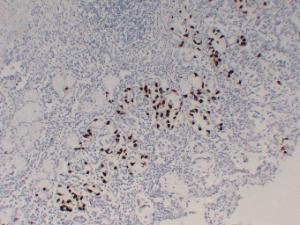 Immunohistochemical analysis of paraffin-embedded human Stomach using Anti-Gastrin Antibody