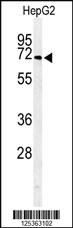 Anti-ARSI Rabbit Polyclonal Antibody