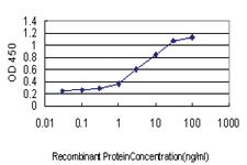 Anti-SPP1 Mouse Monoclonal Antibody [clone: 1E10]