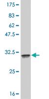 Anti-FOXL1 Mouse Monoclonal Antibody [clone: 1C3]