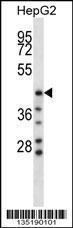 Anti-HYAL1 Rabbit Polyclonal Antibody (APC (Allophycocyanin))