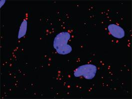 Anti-PDGFRA + PIK3R1 Antibody Pair