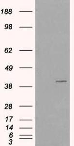 HEK293 overexpressing VPS26A (RC205353) and probed with Anti-VPS26A Antibody (A82694) (mock transfection in first lane), tested by Origene