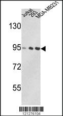 Anti-VCP Rabbit Polyclonal Antibody