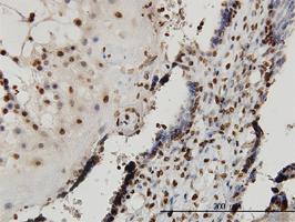 Anti-SMAD7 Mouse Monoclonal Antibody [clone: 1G10]