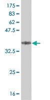 Anti-FOXL1 Mouse Monoclonal Antibody [clone: 2C2]